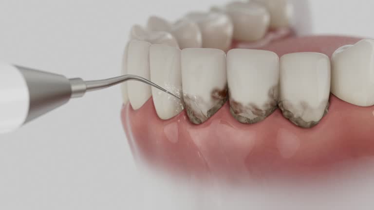 Reliable Dental Implants contractor in Ben Lomond, CA by Smile Center Dentistry